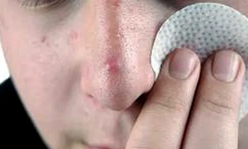 برخی با کاهش دما بیشتر جوش می‌زنند