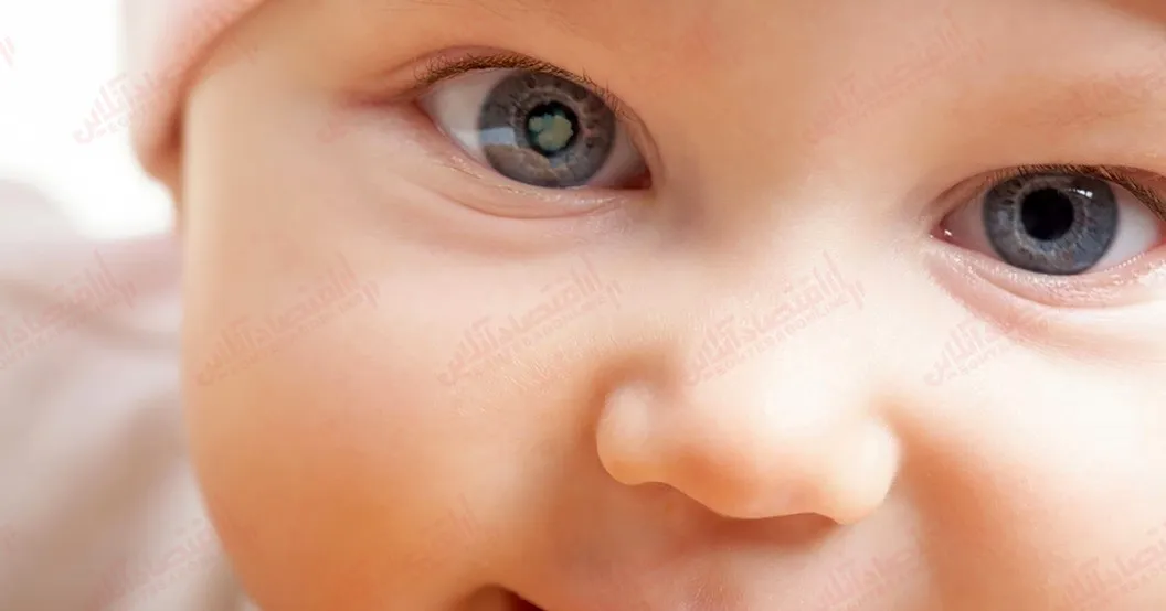 ۸ عفونت شایع چشم و نحوه درمان آن‌ ها