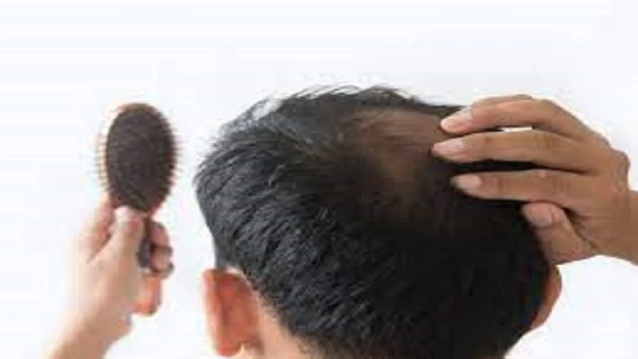 باید نباید های تغذیه بعد از کاشت مو