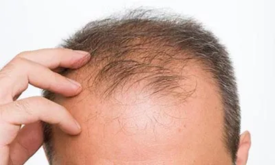 تبلیغ کالا با ادعای درمانی، ممنوع