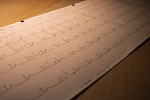 همه آنچه باید از سندرم مرگ ناگهانی بزرگسالان بدانید