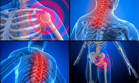 مشکلات اسکلتی و دردهای عضلانی از عوارض ناتمام ابتلا به کرونا