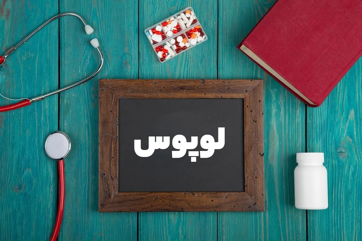 هرآنچه باید از بیماری لوپوس باید بدانید
