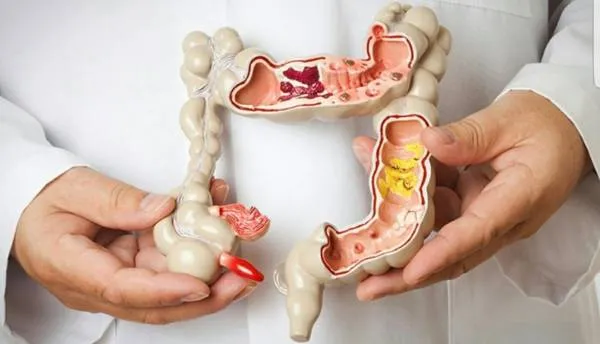 با این ۵ شماره، می فهمی مشکل روده داری یا نه