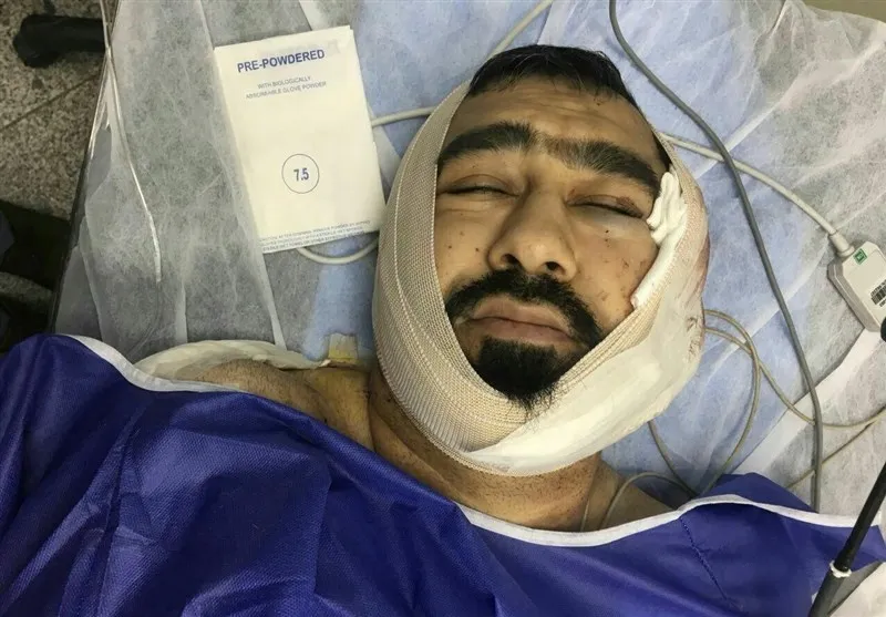حمله خونین به یک طلبه در شرق تهران +عکس