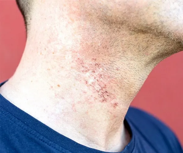 با این کارها پس از اصلاح صورت مشکلی نخواهید داشت+ ۱۰ ماسک خانگی