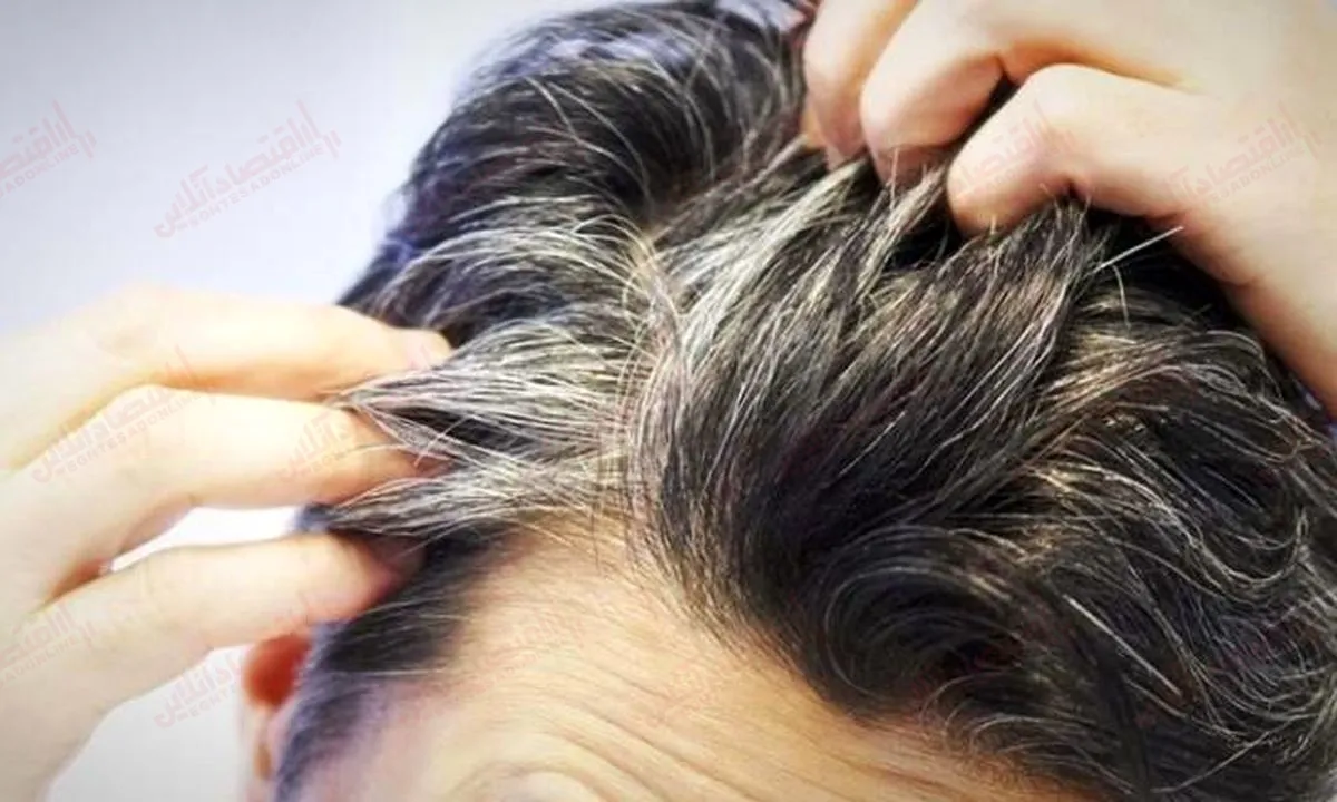 چرا مو‌های ما سفید می شوند؟