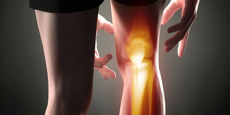 چگونه دچار پوکی «استخوان» نشویم؟