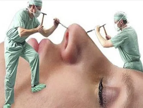 بینی&zwnj;هایی که هر روز کوچکتر می&zwnj;شود