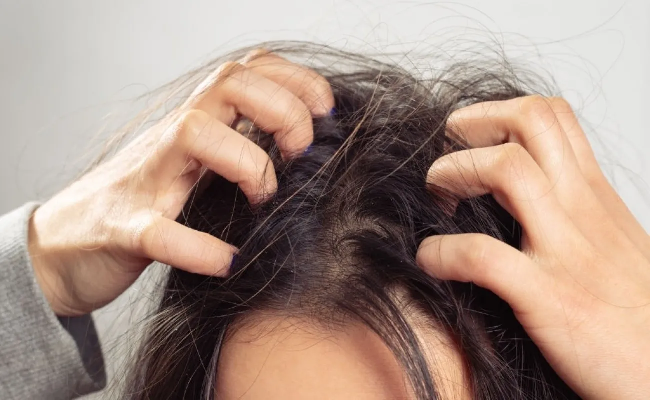 روش هایی برای تضمین سلامت پوست سر