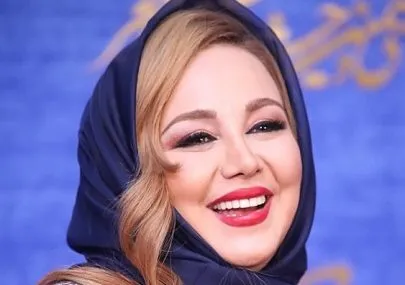 چهره جدید بهنوش بختیاری پس از عمل جراحی + عکس
