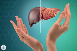 همه چیز درباره درمان کبد چرب / ناشتا برای کبد چرب چی بخوریم؟
