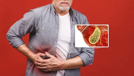 این نشانه ها؛ هشدار دهنده سنگ کیسه صفرا است + رژیم غذایی مناسب
