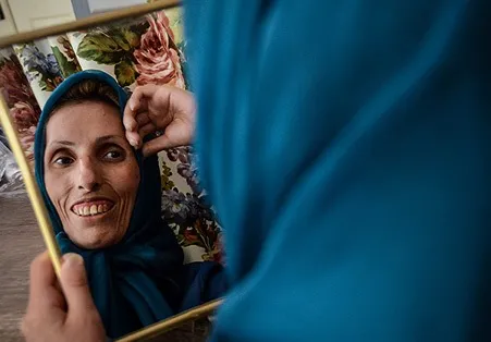 بیماری نادر بانوی کارآفرین +تصاویر