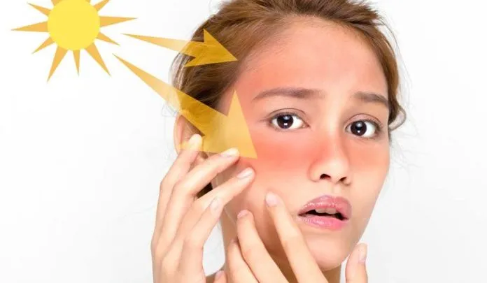 خطرات برنزه کردن پوست را بشناسیم