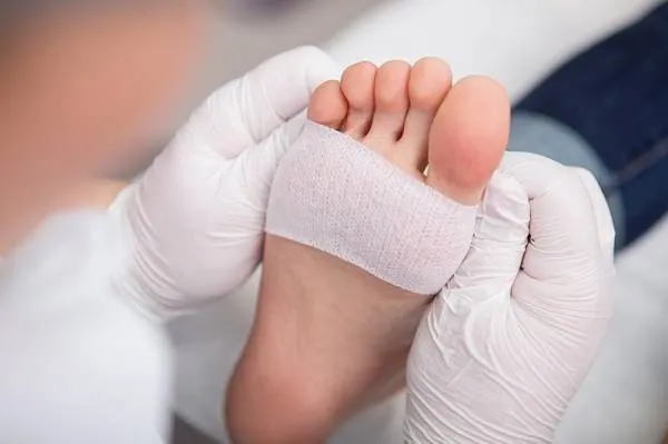 روش صحیح پانسمان زخم دیابتی و جلوگیری از پیشروی آن