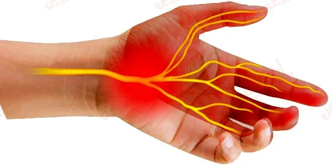 تشخیص علائم هشدار دهنده آسیب عصبی