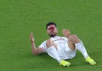 صحنه-دلخراش-کنده-شدن-دندان-امید-عالیشاه-صورت-کاپیتان-غرق-در-خون-شد-فیلم
