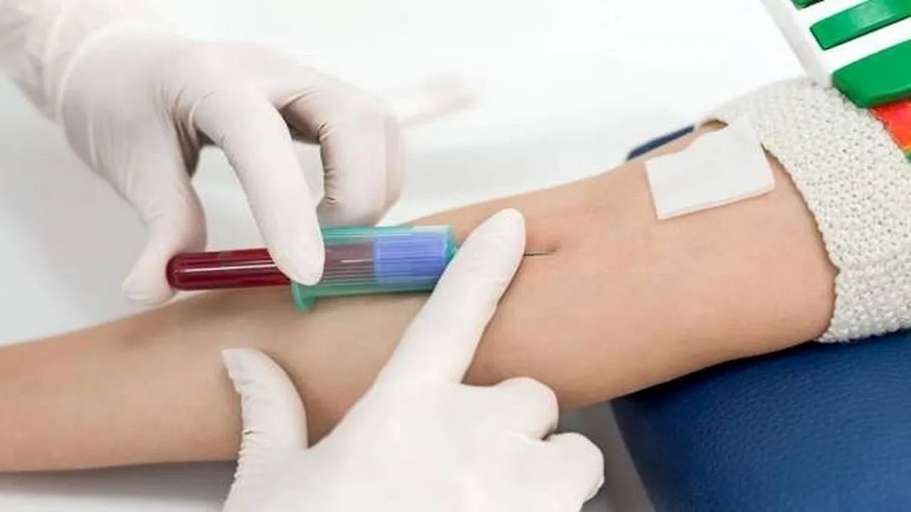 خدمات آزمایشگاهی از پوشش بیمه خارج شد؟
